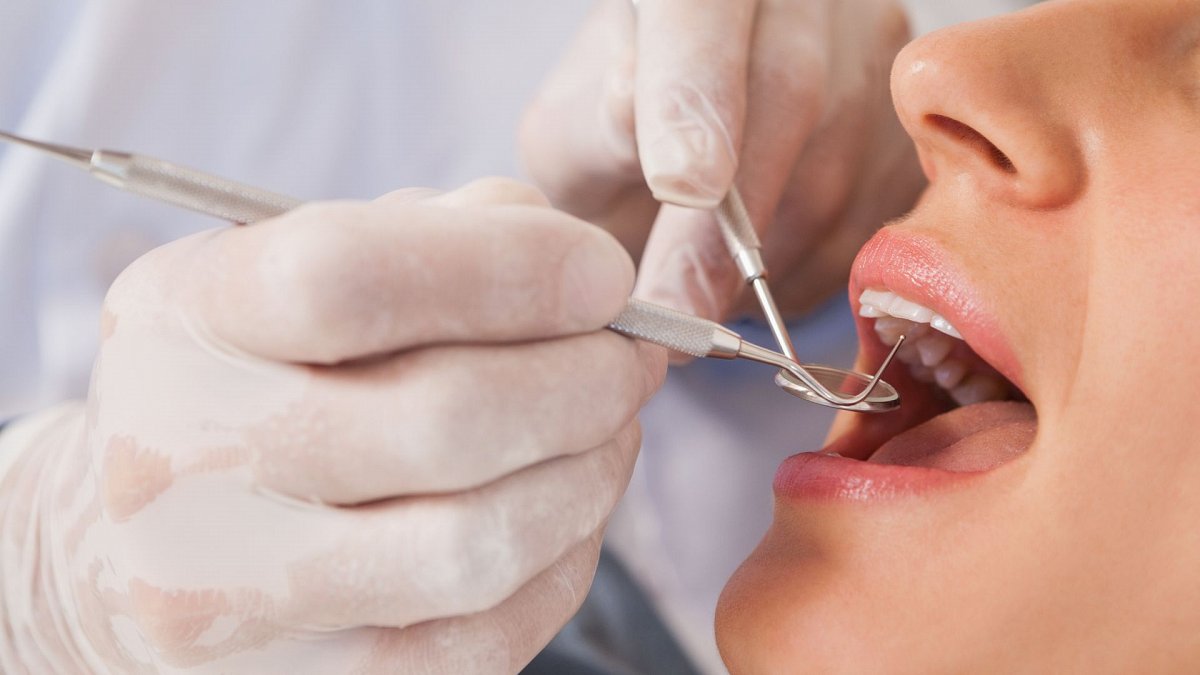 caries dentales caries dentales