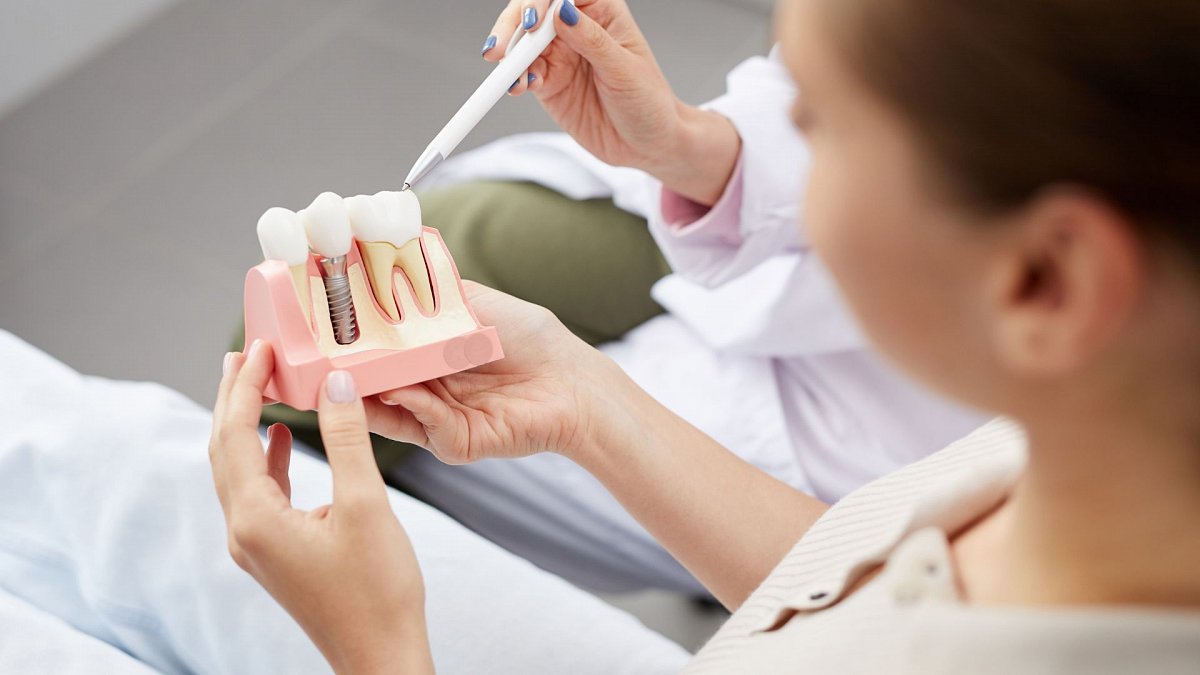 implantes dentales en paterna implantes dentales en paterna
