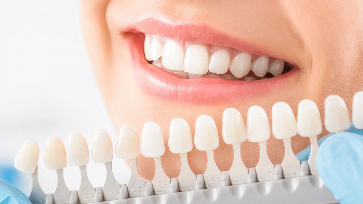 implantes sin tornillos implantes sin tornillos