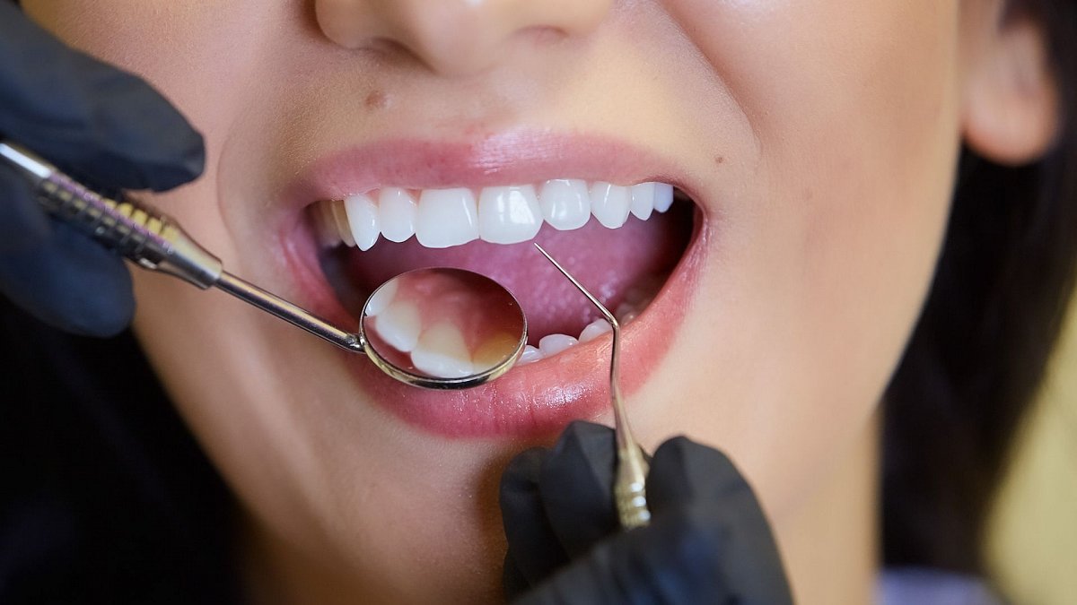 oclusión dental en paterna oclusión dental en paterna
